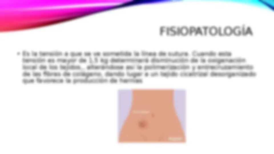 pf15