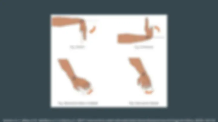 pf4