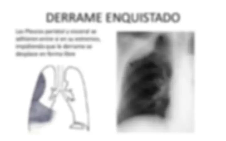 pf14