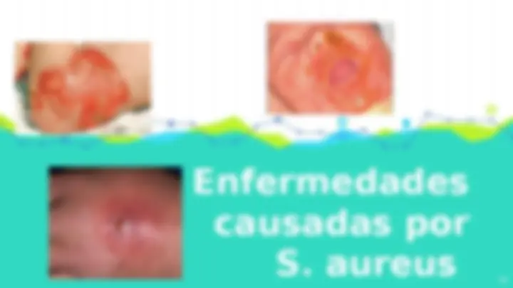 pf34