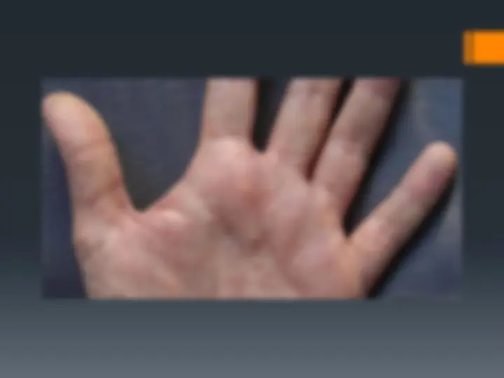 pff