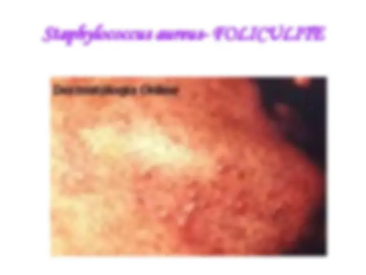 pf5