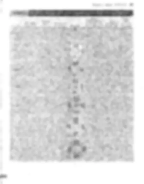 pf4