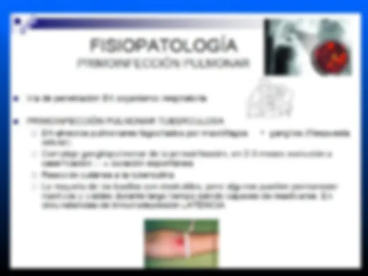 pf4