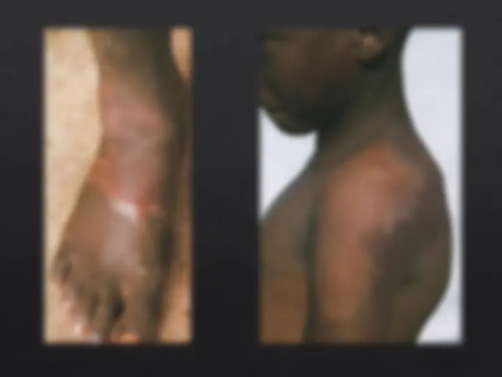pf18