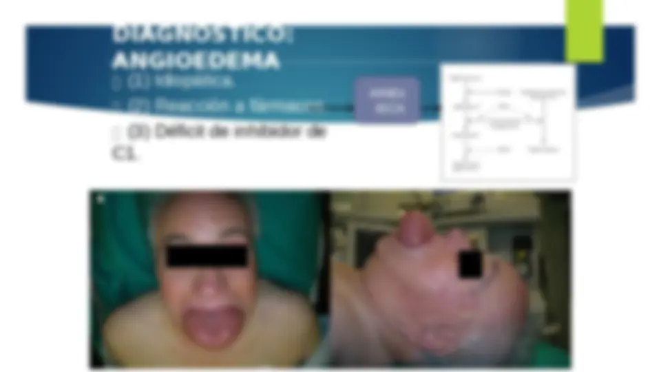pfe