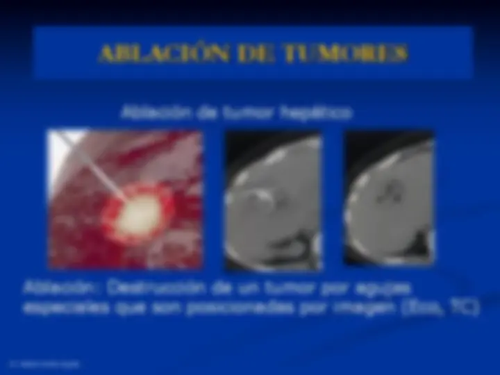 pf3d