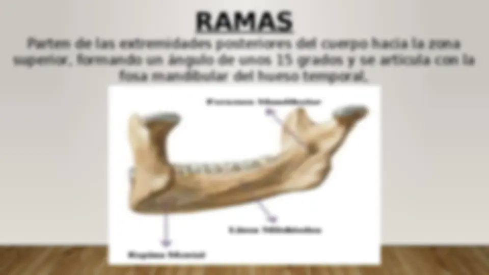 pf5a