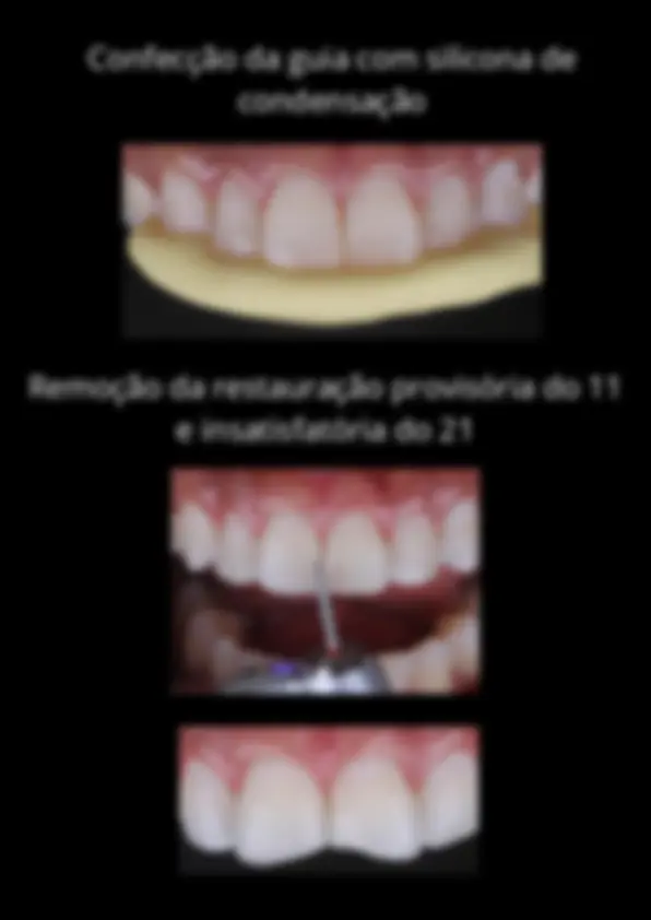 pf49