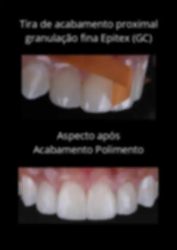 pf4f