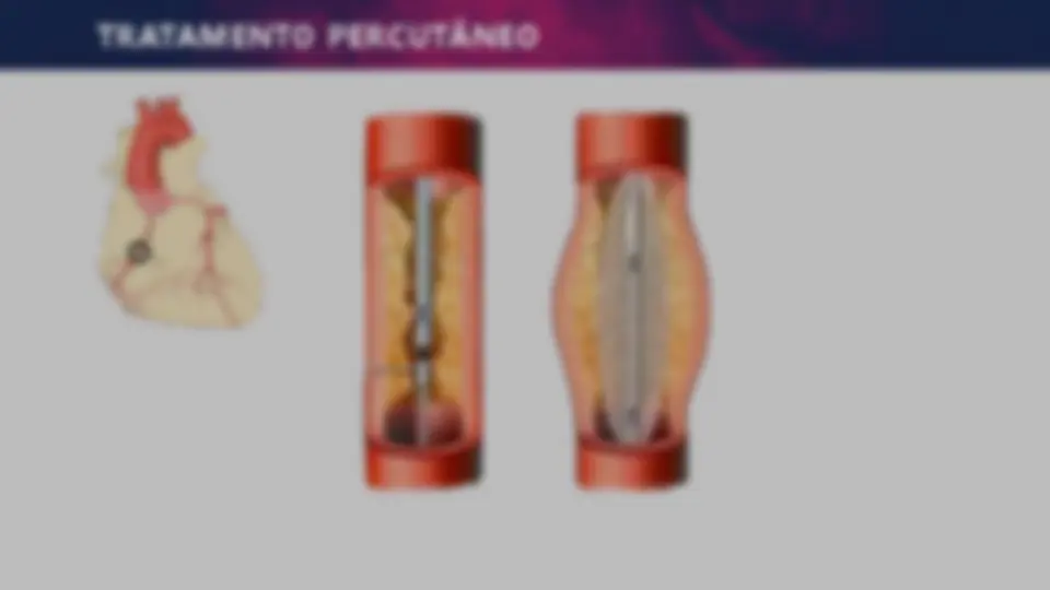 pf4e
