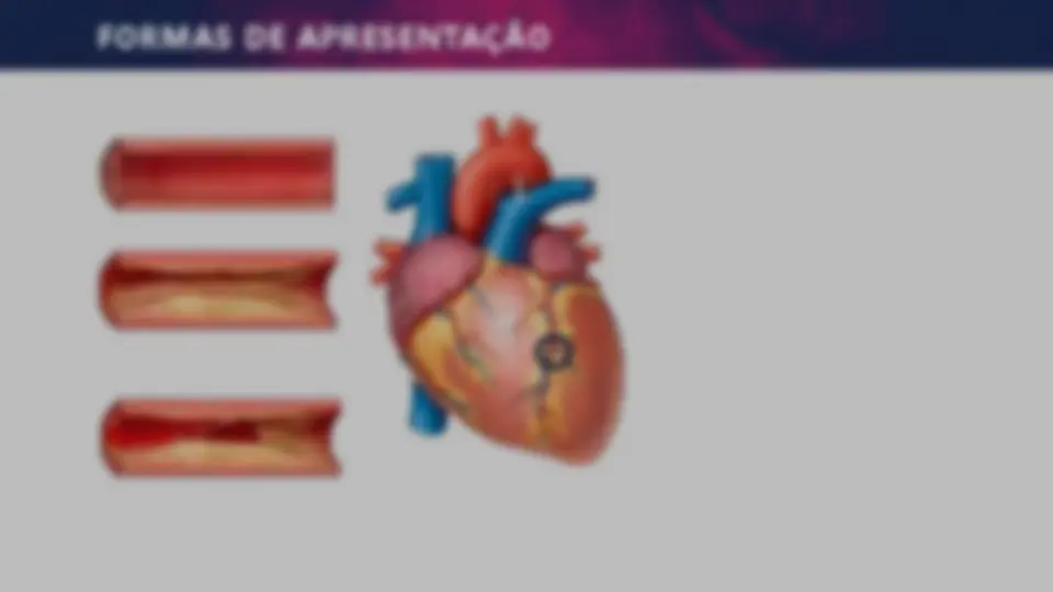 pf14