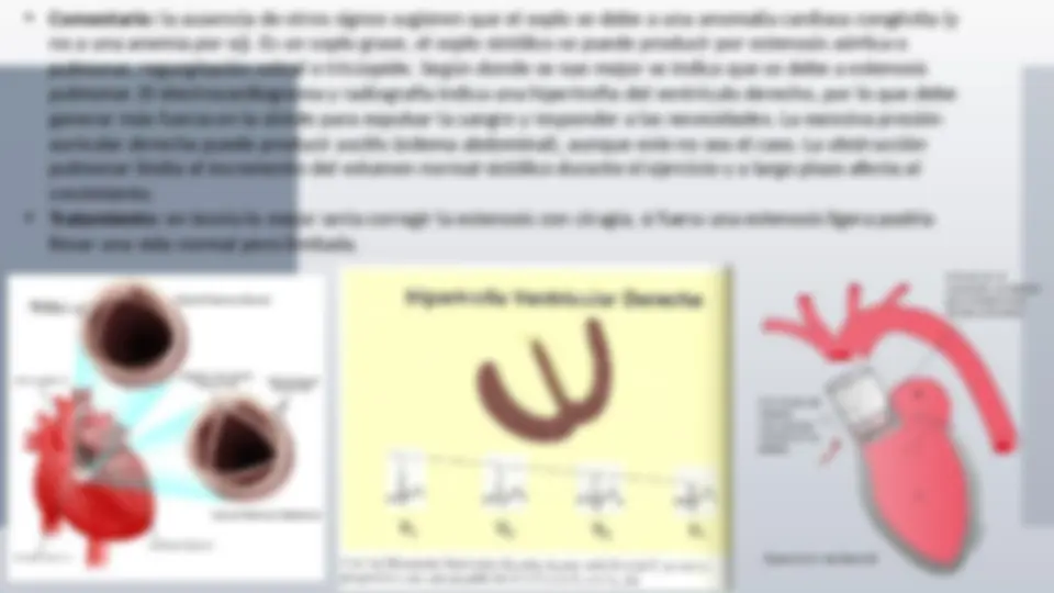 pf29