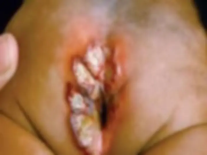 pf24