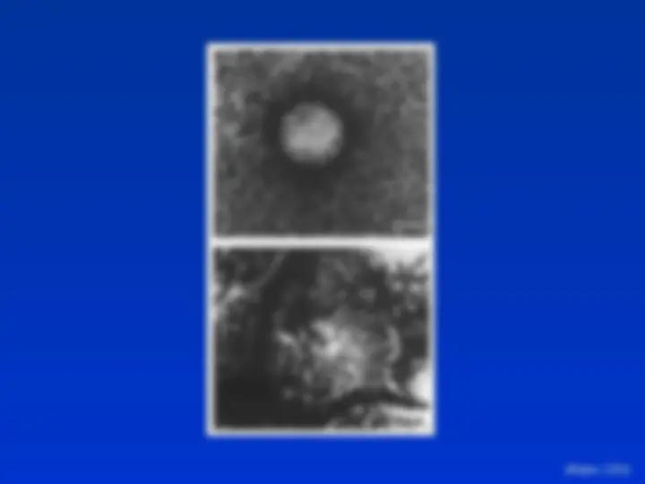 pf14