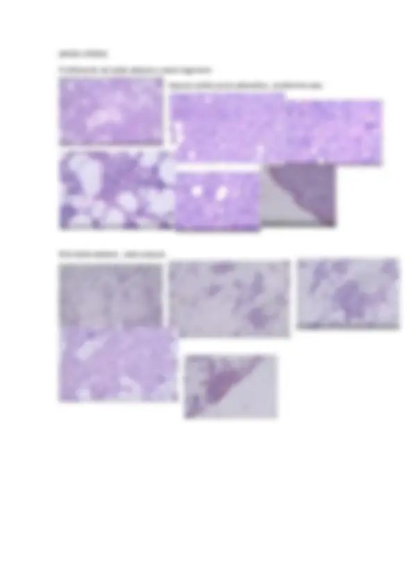 pf5