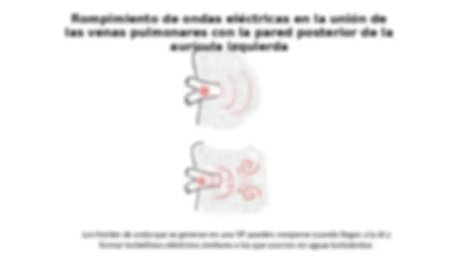 pfe