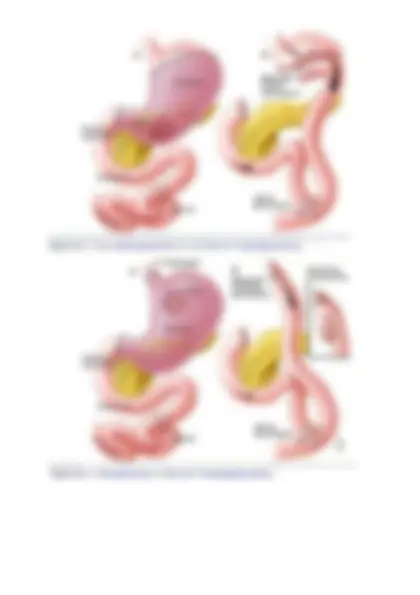 pf62