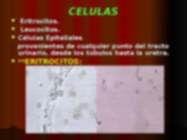 pf1a