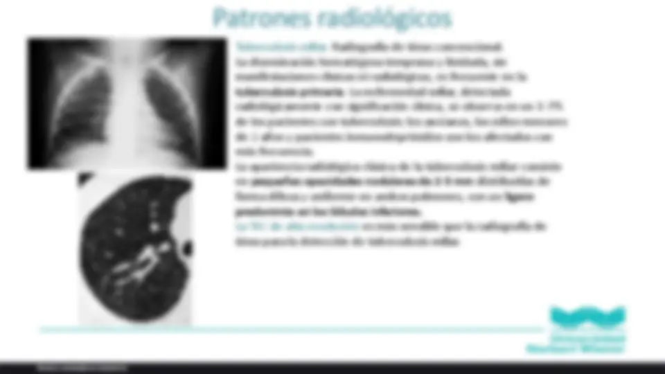 pf1f