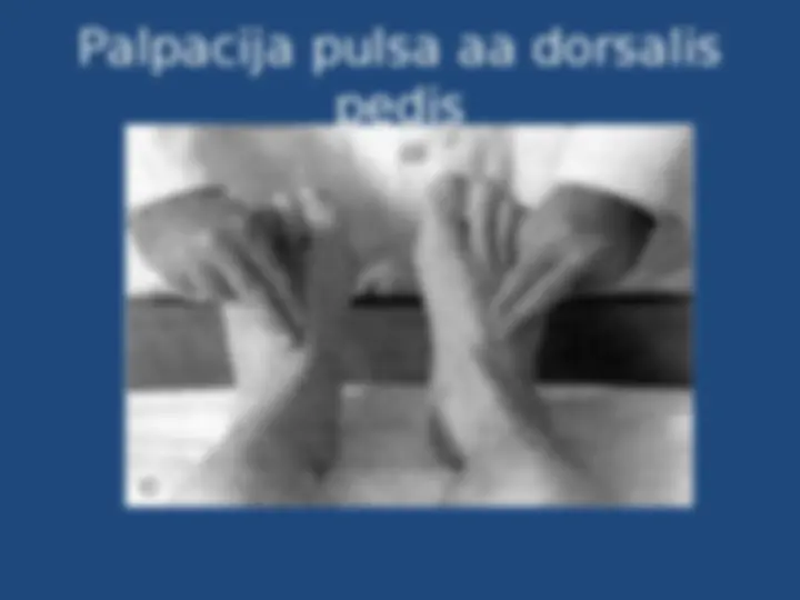 pf17