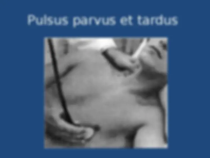 pf12