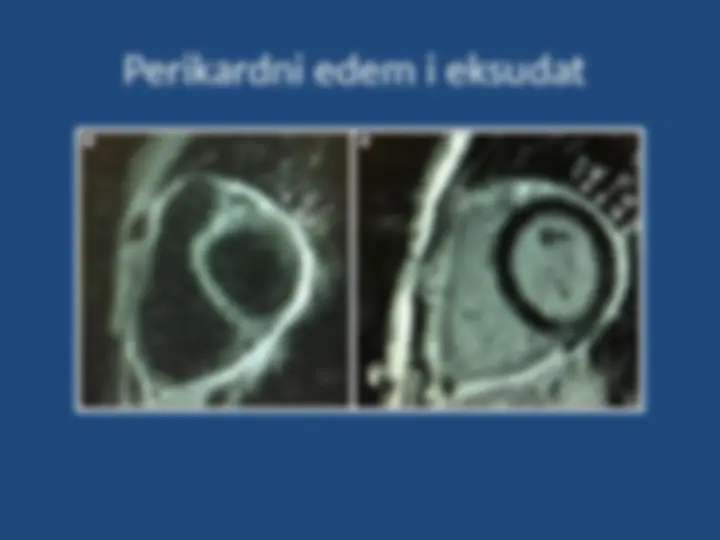 pf34