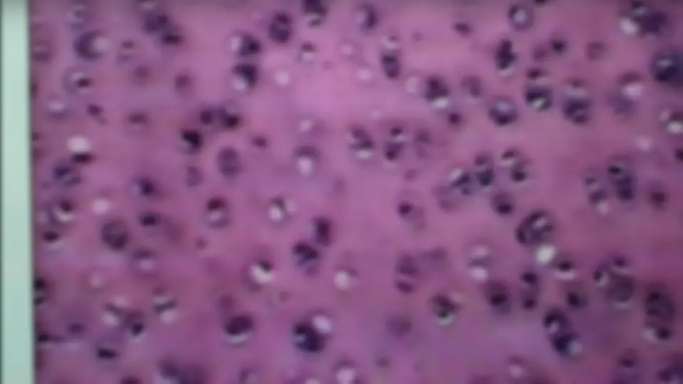 pf3a