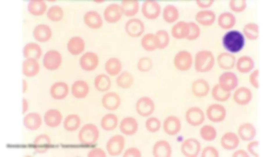 pf38