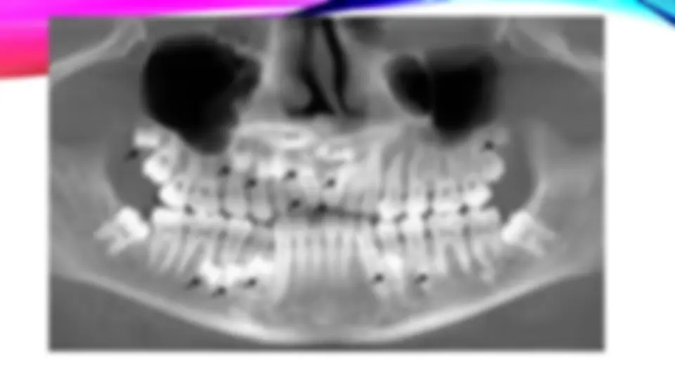 pf34