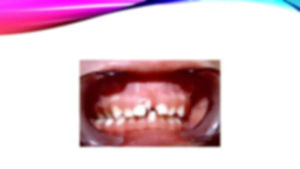 pf31
