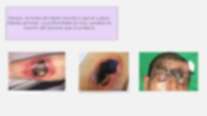 pfe