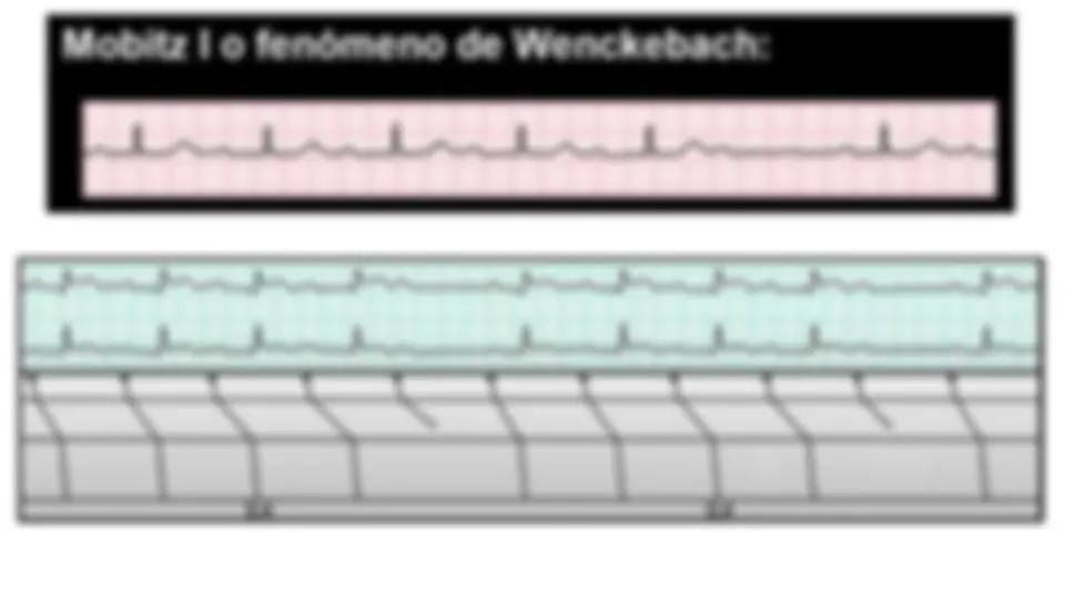 pf12