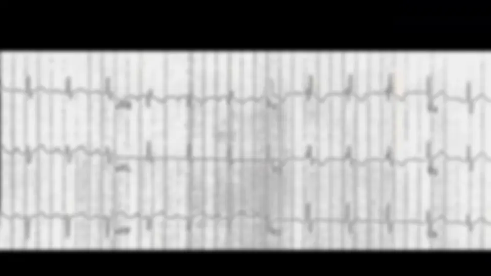 pf2f