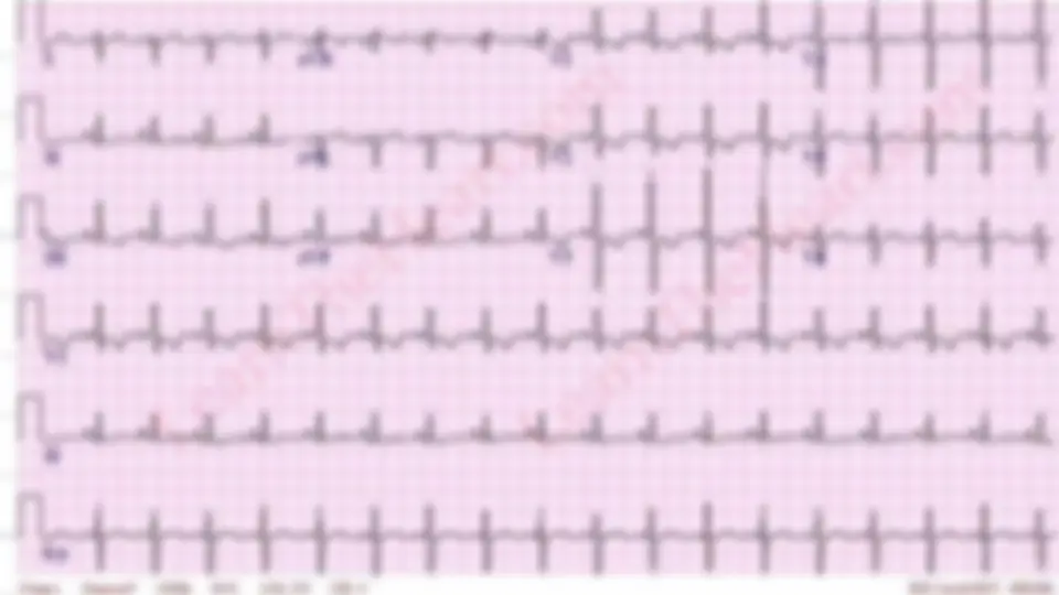 pf29