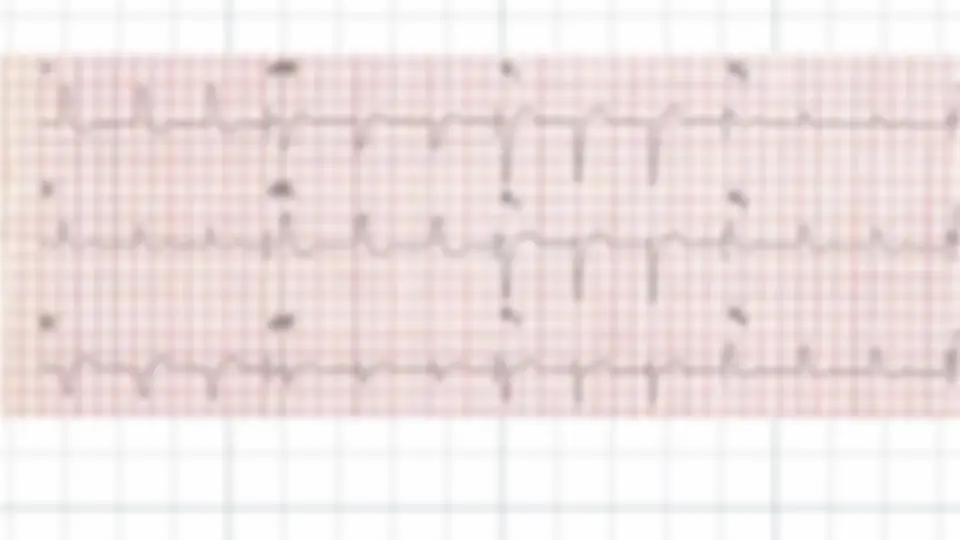 pf27