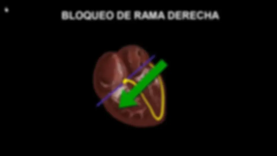 pf2d