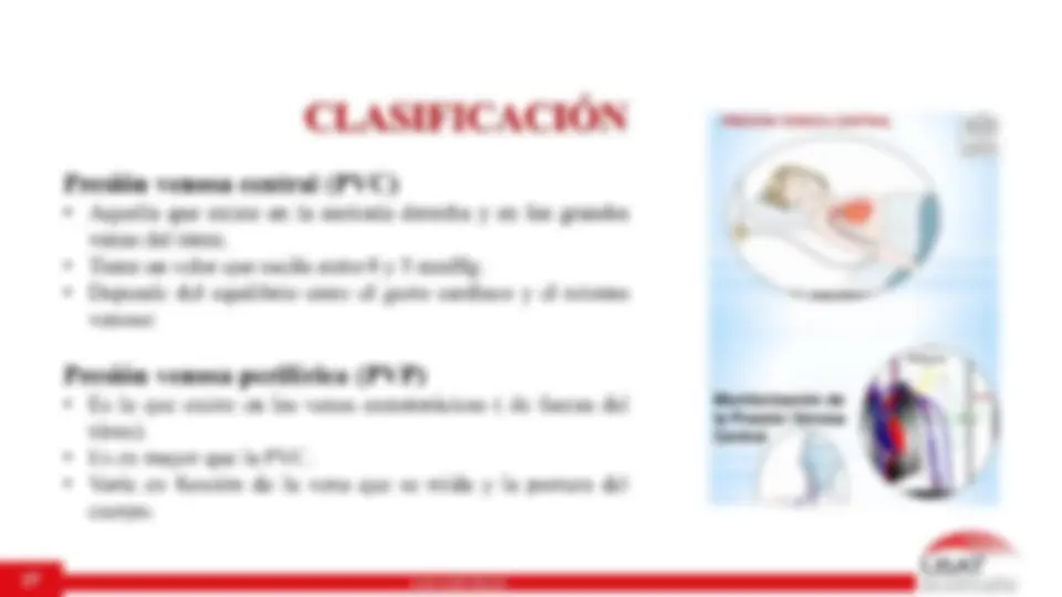 pf1b
