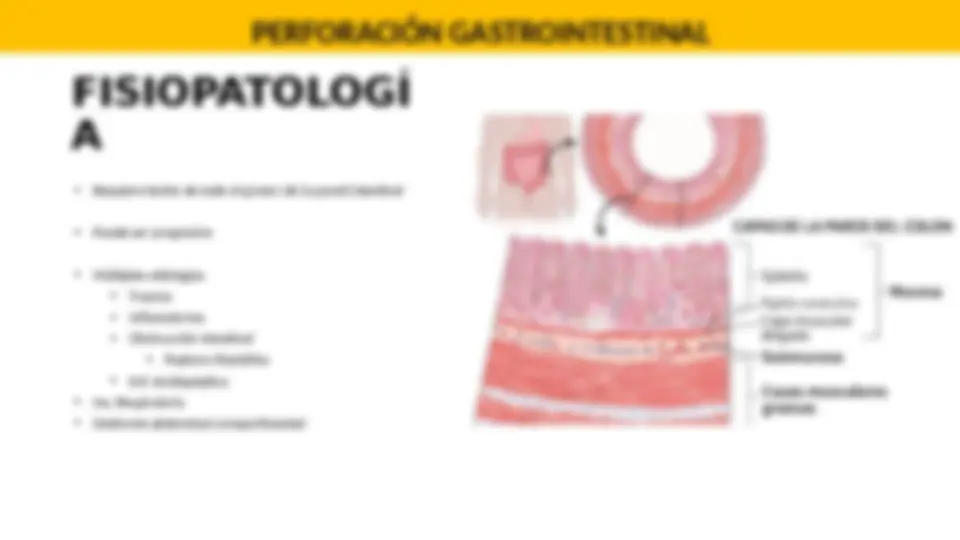 pf14