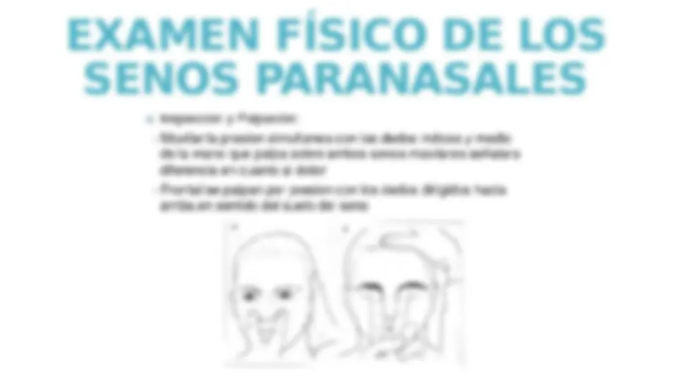 pfe