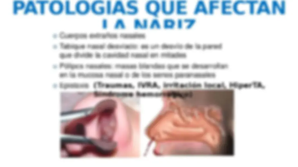 pfa