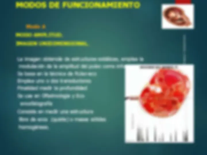 pf21