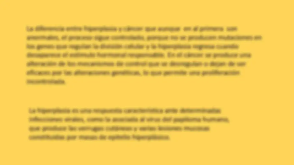 pfe