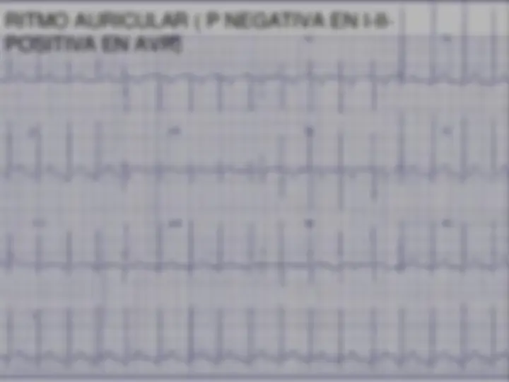 pf52