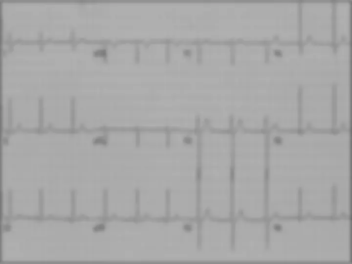 pf45