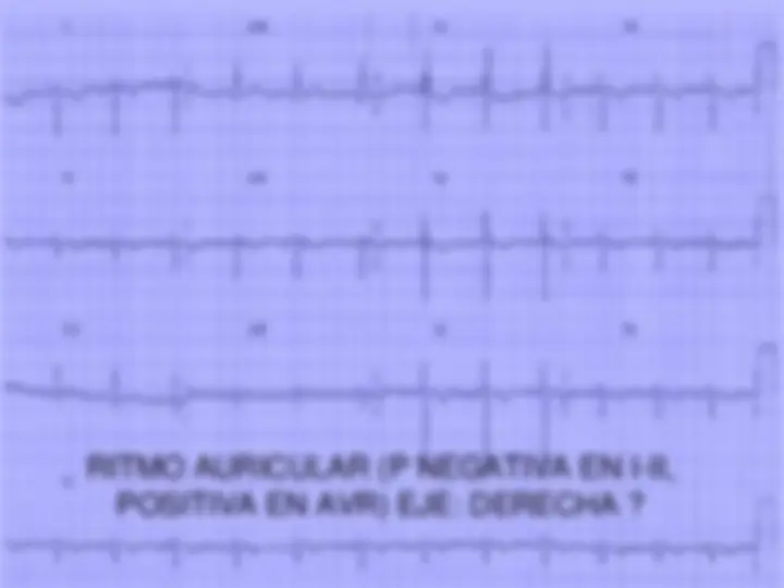 pf50