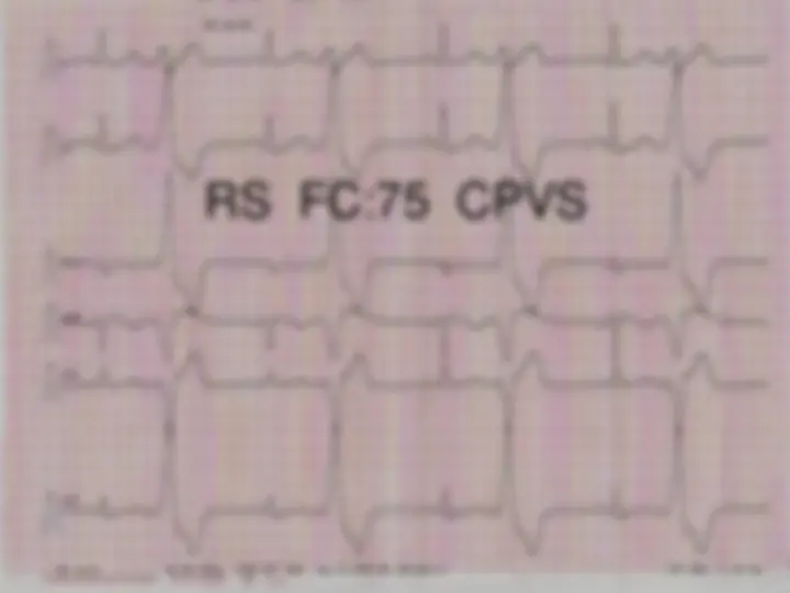 pf54