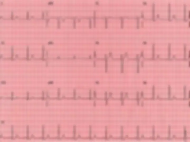 pf49