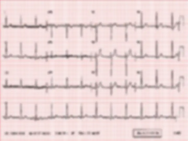 pf43