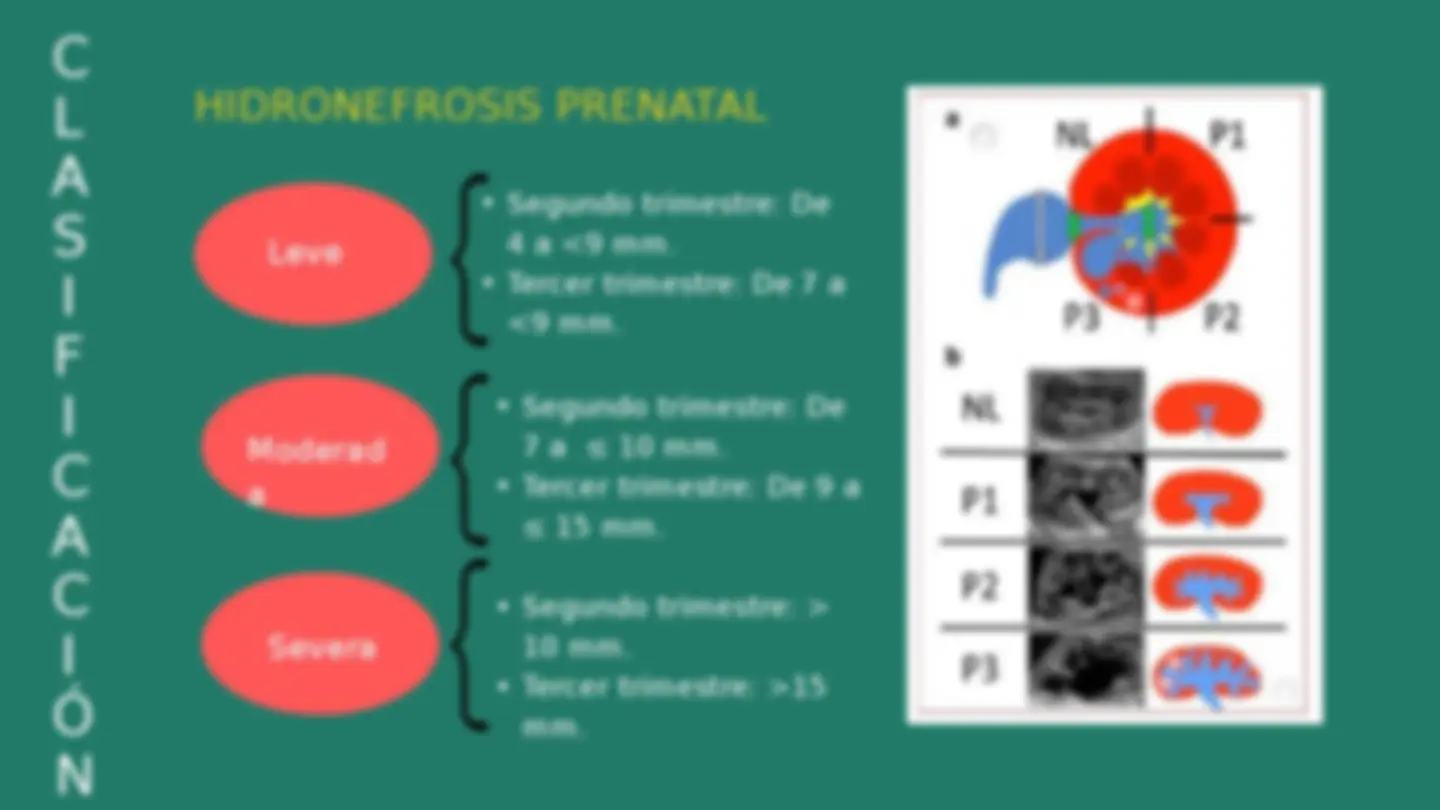 pf4